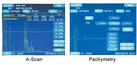 Pengimbas ultrasound mata