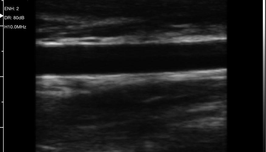 Draadloze lineaire mobiele echografiescanner L7-scan