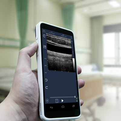 Scanner Ad Ultrasuoni Veterinario Macchina