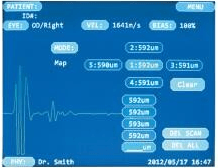 Pachymetry Scan Màu mắt kết quả Hoa Kỳ