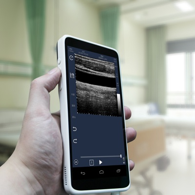 kleuren lineaire echografie scanner