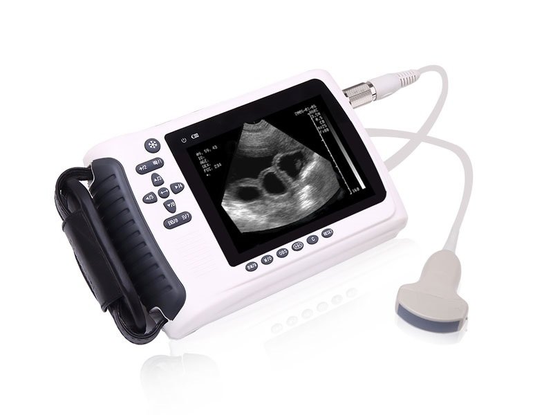 Pemindai Ultrasound Digital Penuh