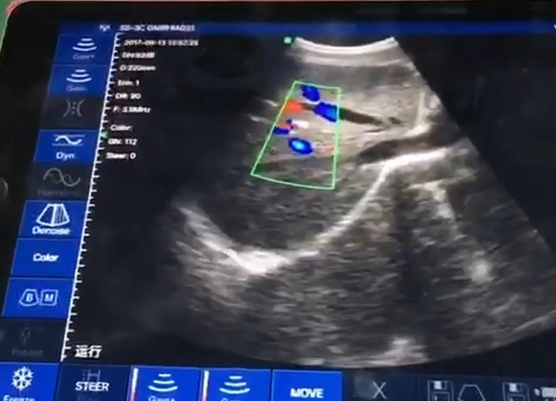 Risultato della scansione dello scanner ad ultrasuoni convesso