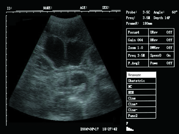 hasil imbasan ultrasound anjing