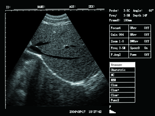 hasil imbasan ultrasound