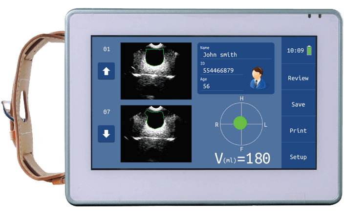 Scanner ad ultrasuoni per vescica 3D wireless Bluetooth per urologiaology