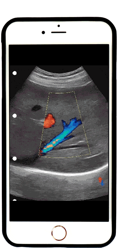 Wifi Ultrasound scanner scan result