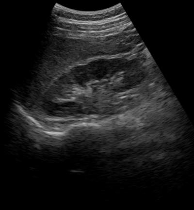 Kidney Imaging 