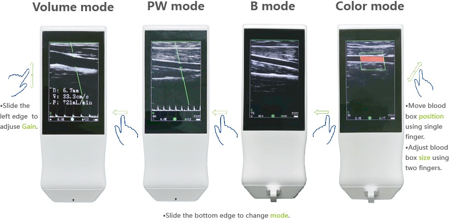 وضع PW B الماسح الضوئي بالموجات فوق الصوتية دوبلر اللون