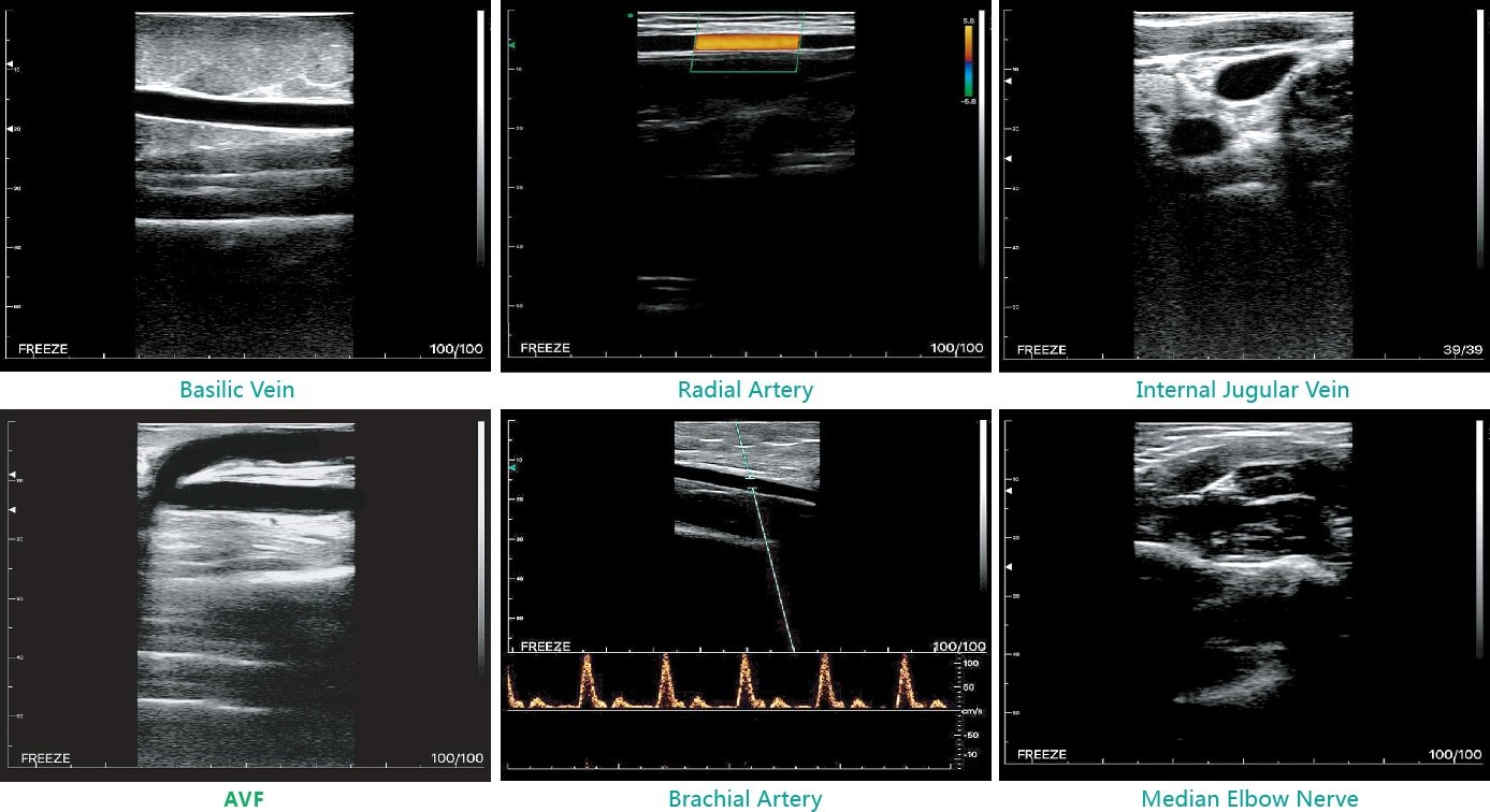  Ultrasound Scanner SCAN RESULTS