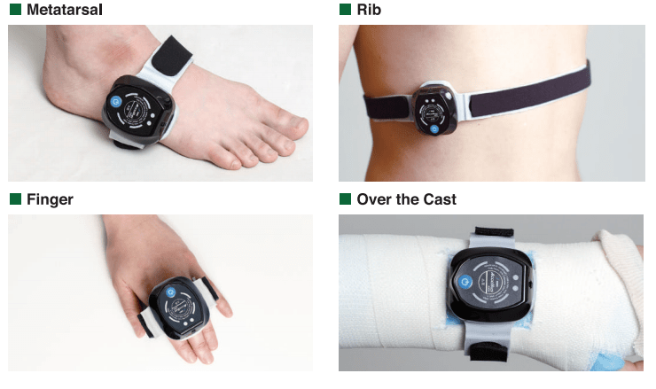 Ultrasound Bone Healing System SIFBONE-1.0 Application