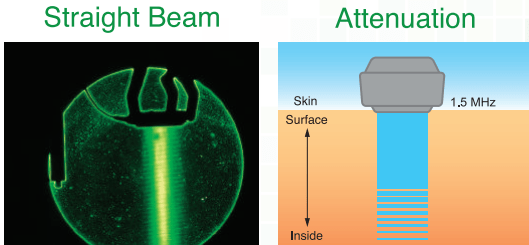 Ultrasound Bone Healing System SIFBONE-1.0  Beam Scheme