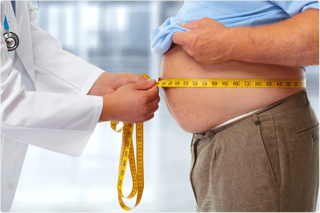 Obesity Related High Blood Pressure SIFSOF Obesity Related High Blood Pressure SIFSOF